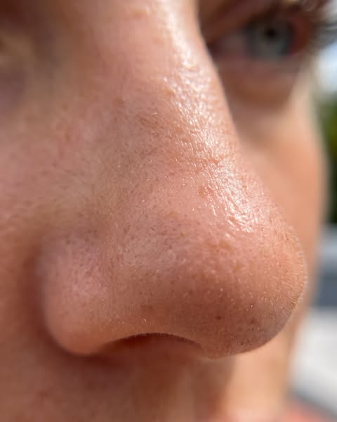 Macro photograph of a nose in daylight showing pores and fine facial hair